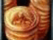 Peterdiz